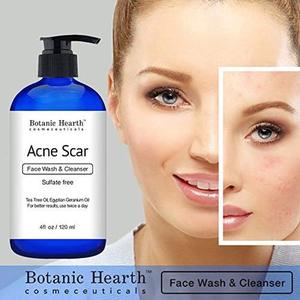Botanic Hearth Acne Scar Face Wash & Cleanser