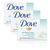 Dove Sensitive Skin Beauty Bar 3 Pack (100g per pack)